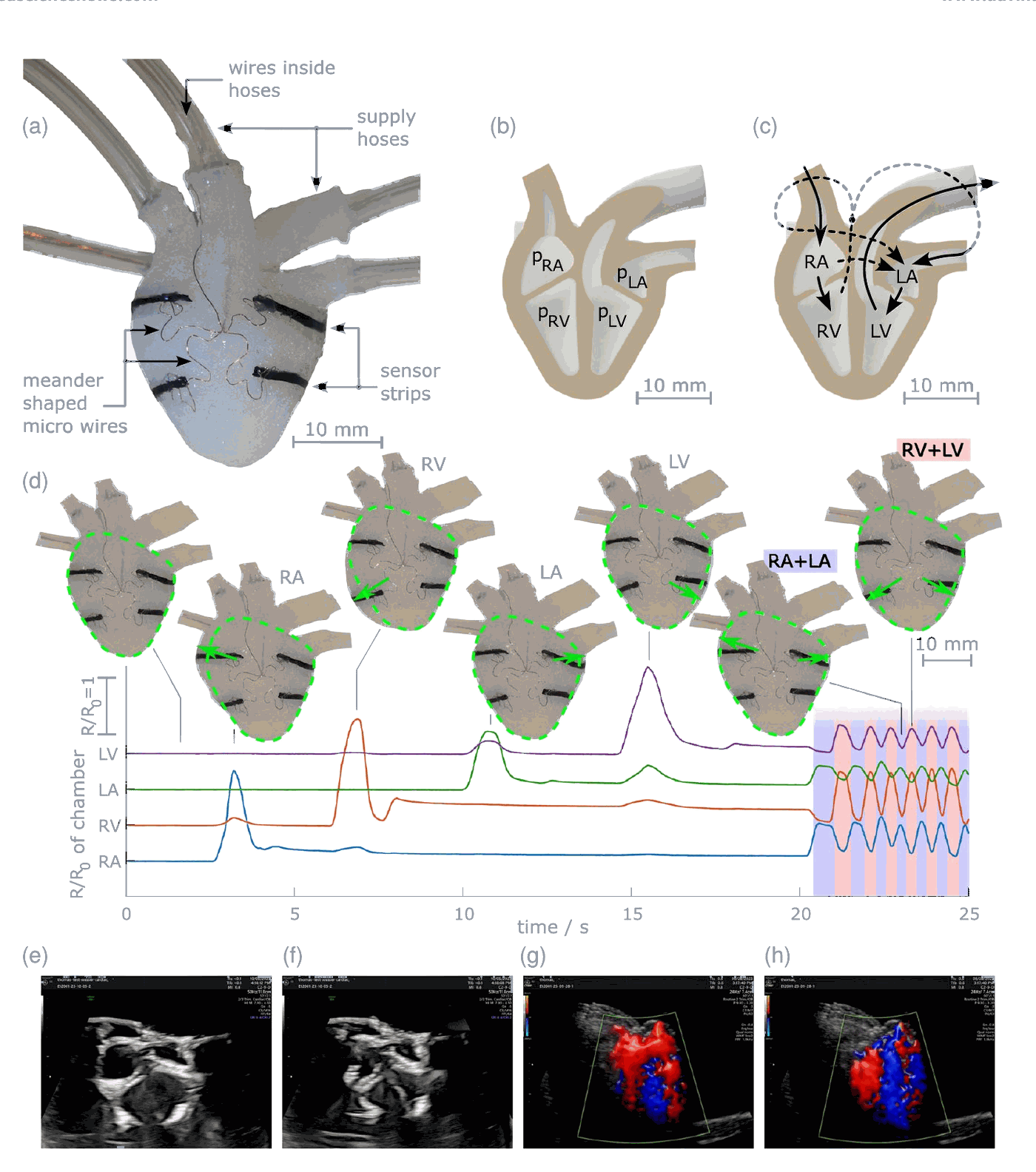 Silicone fetal heart with sensor strips, chamber layouts, sensor signals during beating, and ultrasound and Doppler images