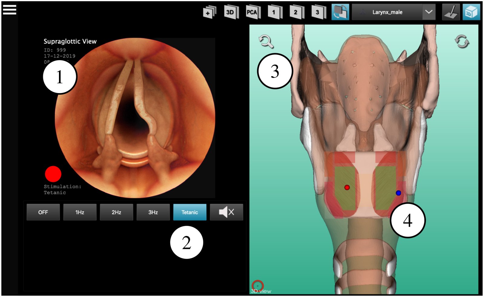 Simulator software with vocal fold animation, stimulation buttons and a 3D larynx view with marked insertion points