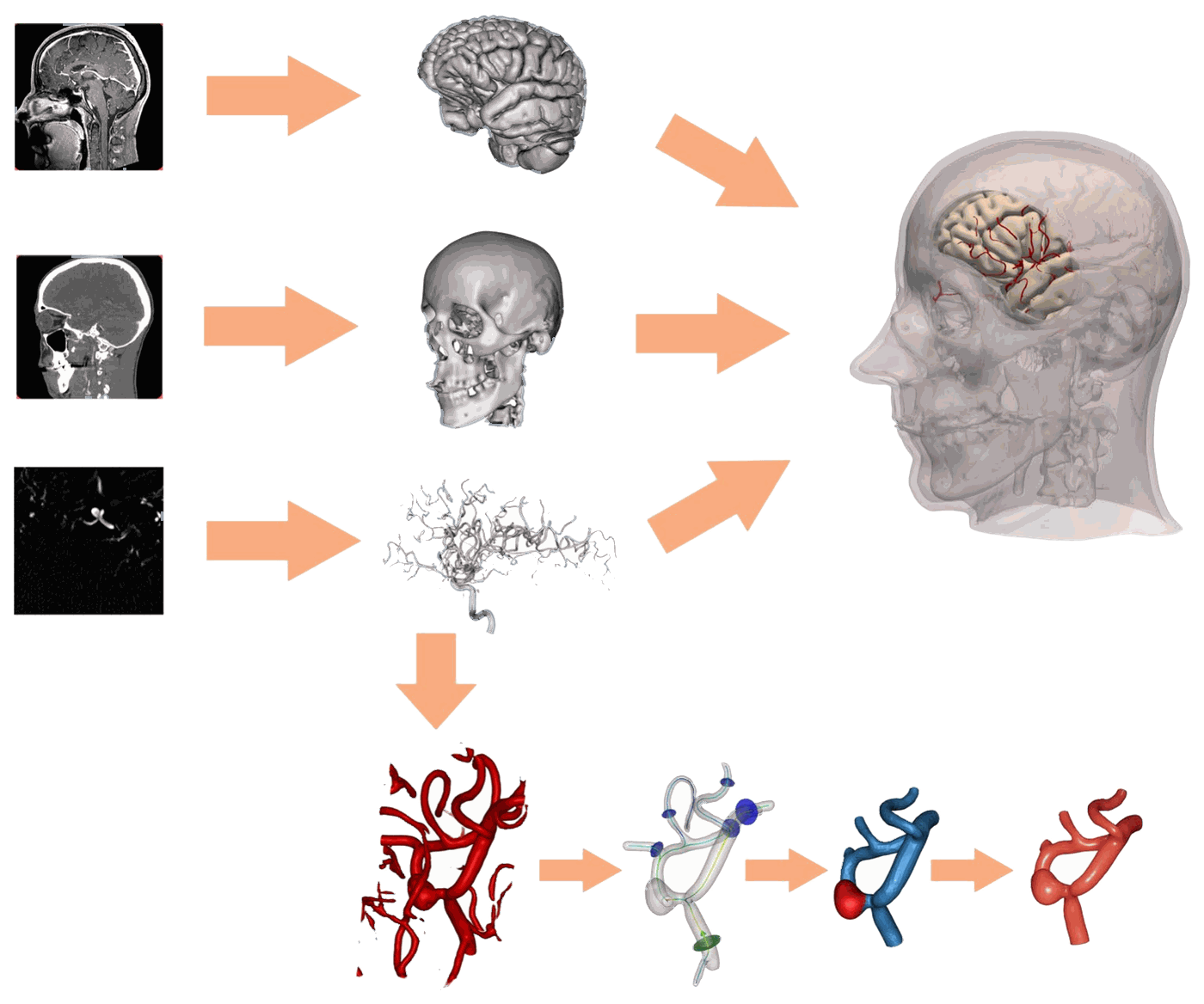 Processing pipeline from CT, MRI and angiography images to a patient-specific 3D model of skull, brain and vessels